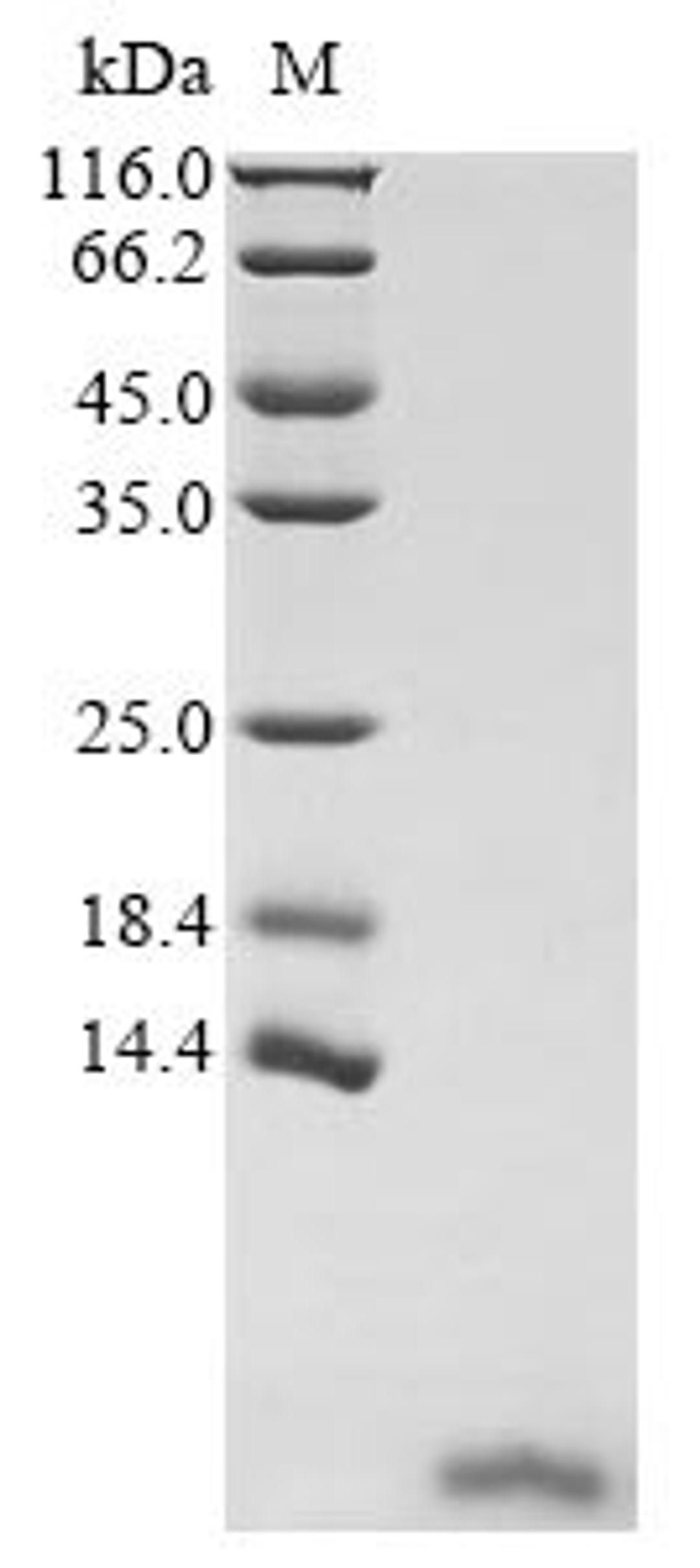 (Tris-Glycine gel) Discontinuous SDS-PAGE (reduced) with 5% enrichment gel and 15% separation gel.