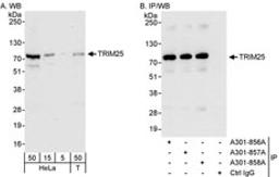 Detection of human TRIM25 by western blot and immunoprecipitation.