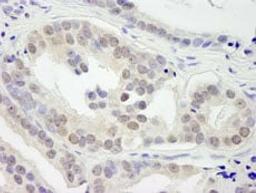 Detection of human JMJD1B by immunohistochemistry.