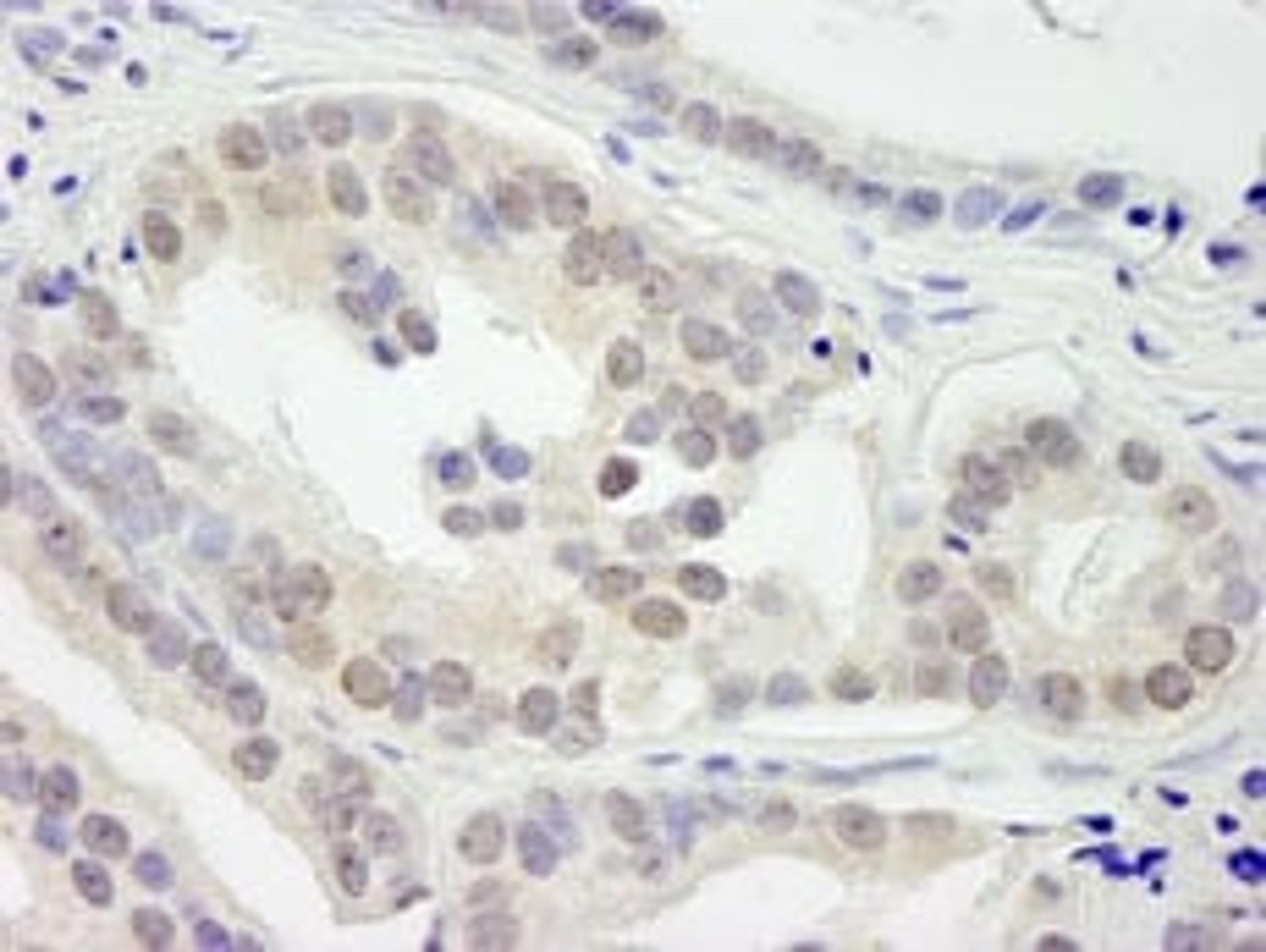 Detection of human JMJD1B by immunohistochemistry.