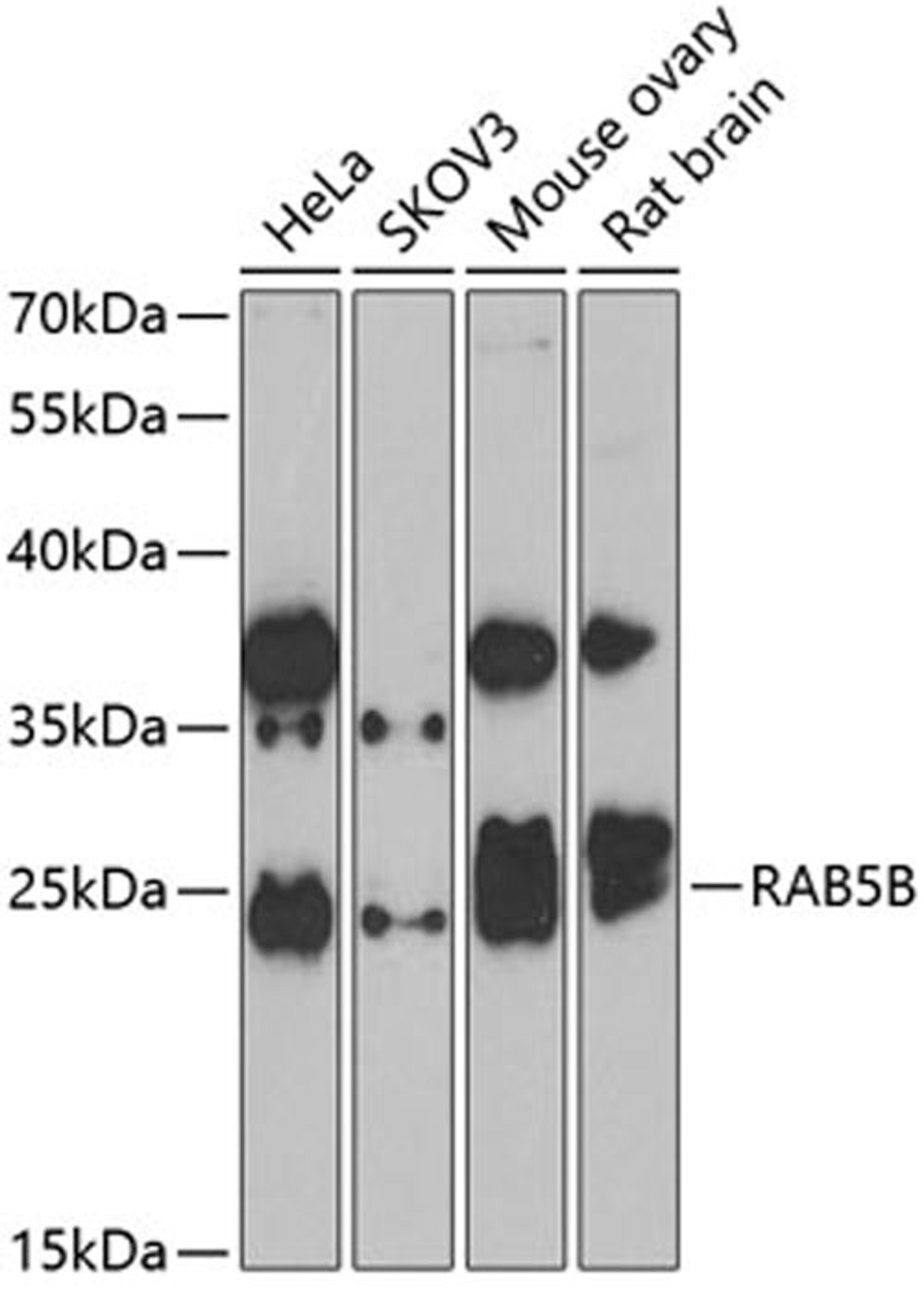 Western blot - RAB5B antibody (A7447)