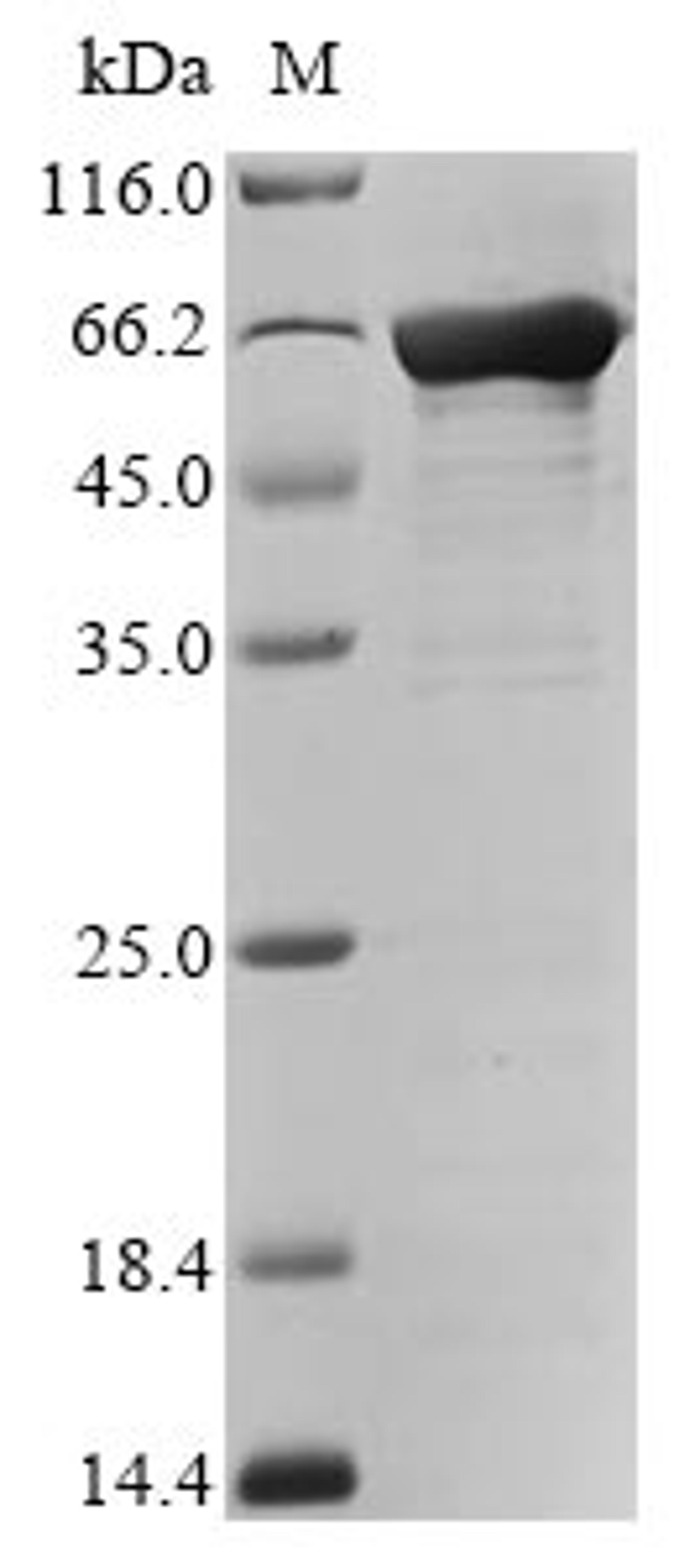 (Tris-Glycine gel) Discontinuous SDS-PAGE (reduced) with 5% enrichment gel and 15% separation gel.