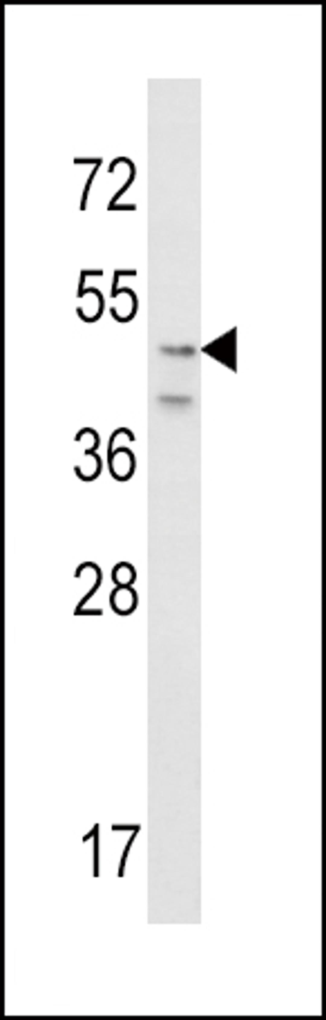 Western blot analysis of CRHR2 Antibody in NIH-3T3 cell line lysates (35ug/lane)