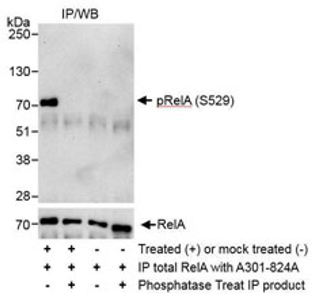 Detection of human Phospho RelA (S529) by western blot of immunoprecipitates.