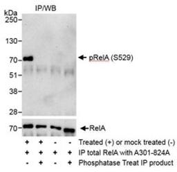 Detection of human Phospho RelA (S529) by western blot of immunoprecipitates.