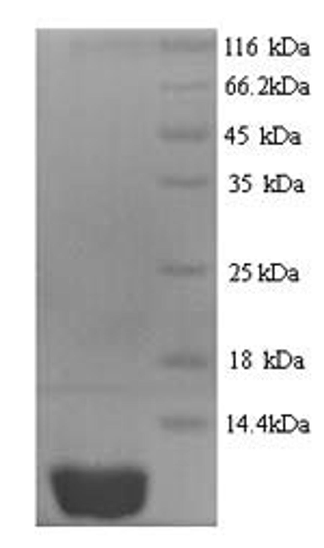 (Tris-Glycine gel) Discontinuous SDS-PAGE (reduced) with 5% enrichment gel and 15% separation gel.