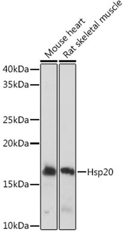 Western blot - Hsp20 Rabbit mAb (A9091)