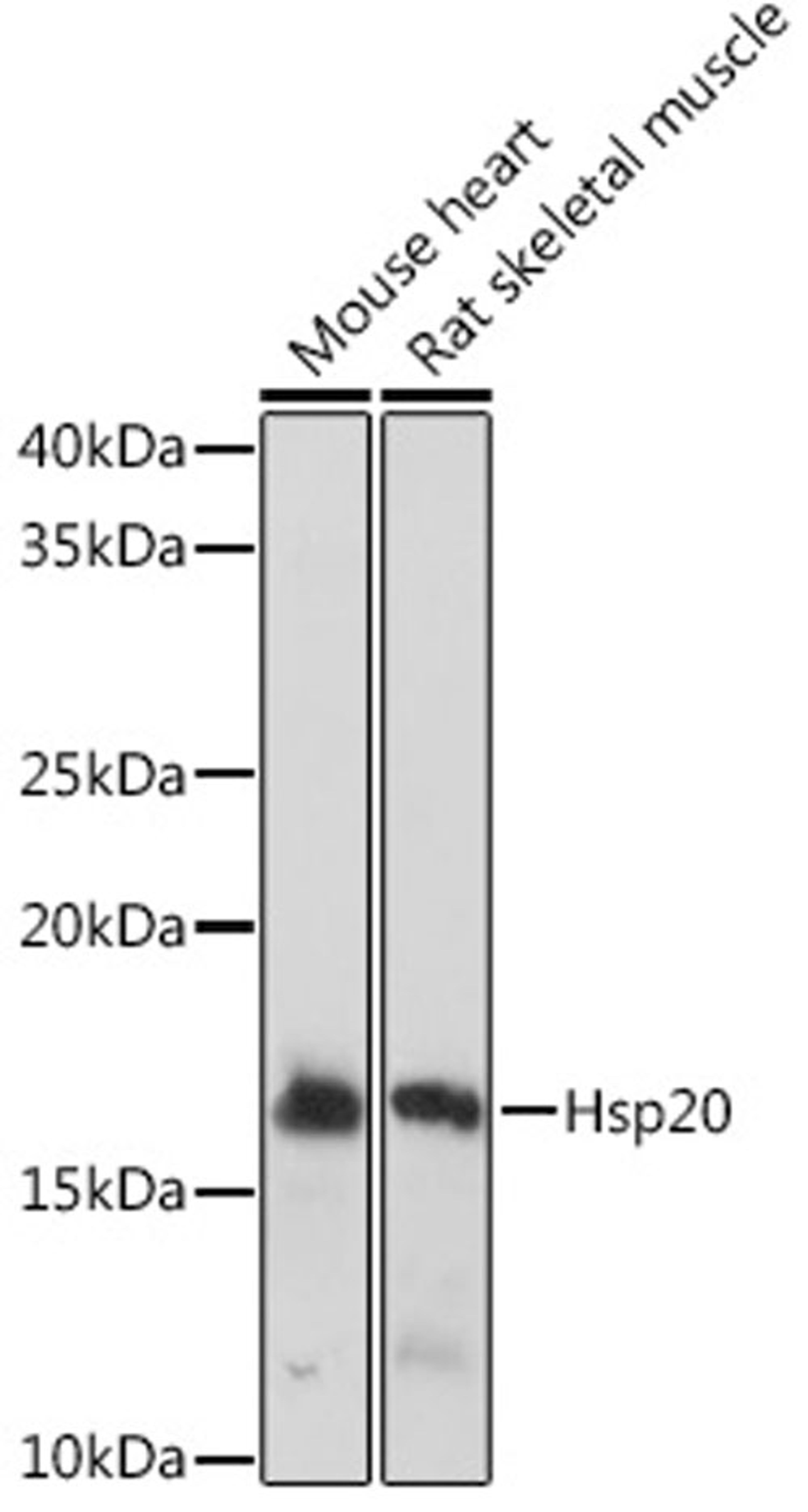 Western blot - Hsp20 Rabbit mAb (A9091)