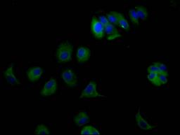Immunofluorescence staining of MCF7 Cells with CSB-RA937008A0HU at 1:50, counter-stained with DAPI. The cells were fixed in 4% formaldehyde and blocked in 10% normal Goat Serum. The cells were then incubated with the antibody overnight at 4℃. Nuclear DNA was labeled in blue with DAPI. The secondary antibody was FITC-conjugated AffiniPure Goat Anti-Rabbit IgG (H+L).