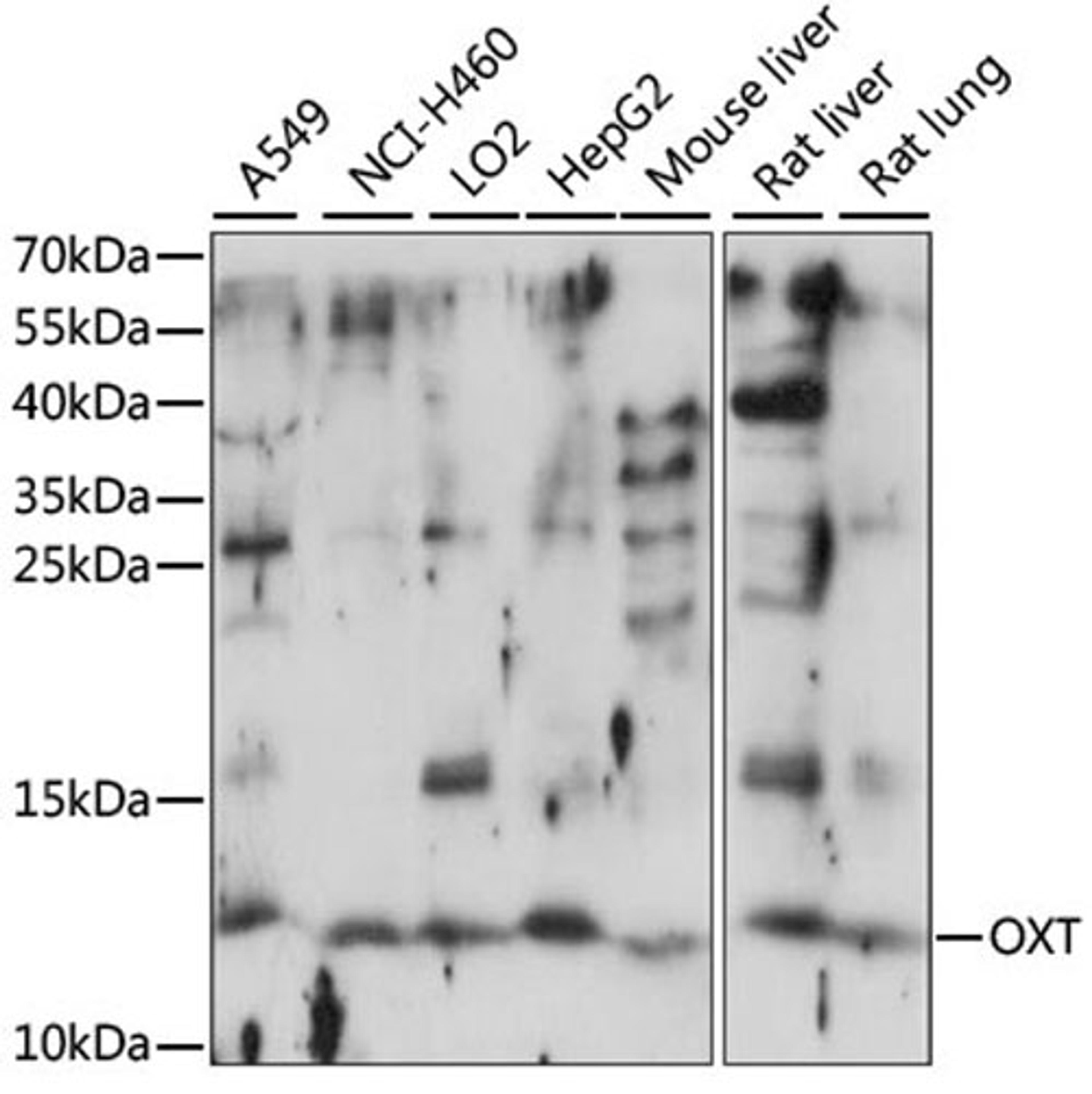 Western blot - OXT antibody (A15296)