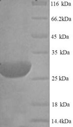 (Tris-Glycine gel) Discontinuous SDS-PAGE (reduced) with 5% enrichment gel and 15% separation gel.