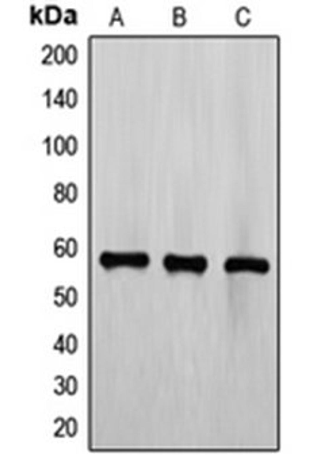 Western blot analysis of CCRFCEM (Lane 1), Jurkat (Lane 2), K562 (Lane 3) whole cell lysates using ETV6 antibody