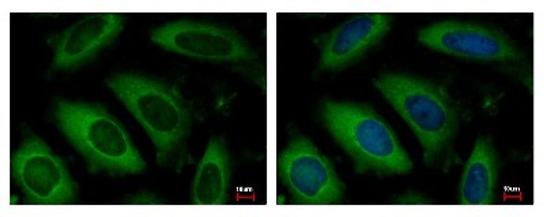 Immunocytochemistry/Immunofluorescence: NAA10 Antibody [NBP2-19461] - Detection of NAA10 protein at Cytoplasm by immunofluorescent analysis. Sample: HeLa cells were fixed in -20C 100% MeOH for 5 min. Green: NAA10 protein stained by ARD1A antibody diluted at 1:500. Blue: Hoechst 33343 staining.