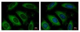 Immunocytochemistry/Immunofluorescence: NAA10 Antibody [NBP2-19461] - Detection of NAA10 protein at Cytoplasm by immunofluorescent analysis. Sample: HeLa cells were fixed in -20C 100% MeOH for 5 min. Green: NAA10 protein stained by ARD1A antibody diluted at 1:500. Blue: Hoechst 33343 staining.