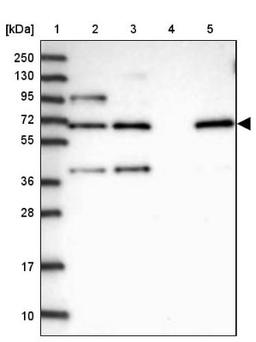 Western Blot: FAM13A Antibody [NBP1-88825] - Lane 1: Marker [kDa] 250, 130, 95, 72, 55, 36, 28, 17, 10<br/>Lane 2: Human cell line RT-4<br/>Lane 3: Human cell line U-251MG sp<br/>Lane 4: Human plasma (IgG/HSA depleted)<br/>Lane 5: Human liver tissue