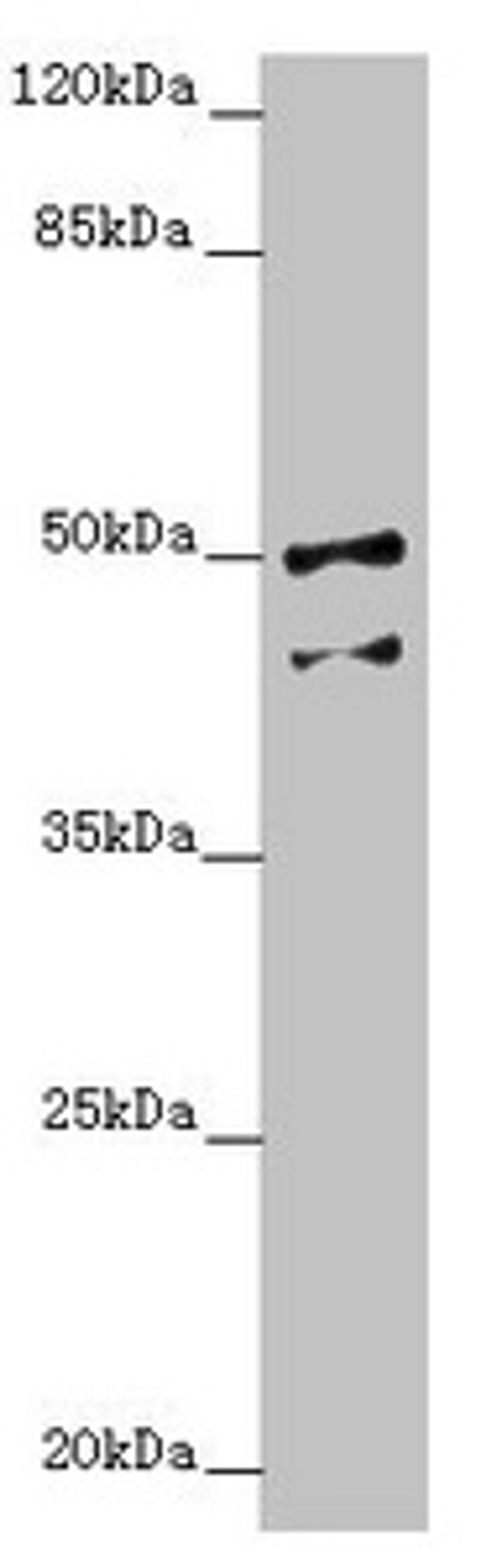 Western blot. All lanes: NPTN antibody at 4.37 ug/ml + Hela whole cell lysate. Secondary. Goat polyclonal to rabbit IgG at 1/10000 dilution. Predicted band size: 45, 32, 31, 38, 44 kDa. Observed band size: 45, 50 kDa.