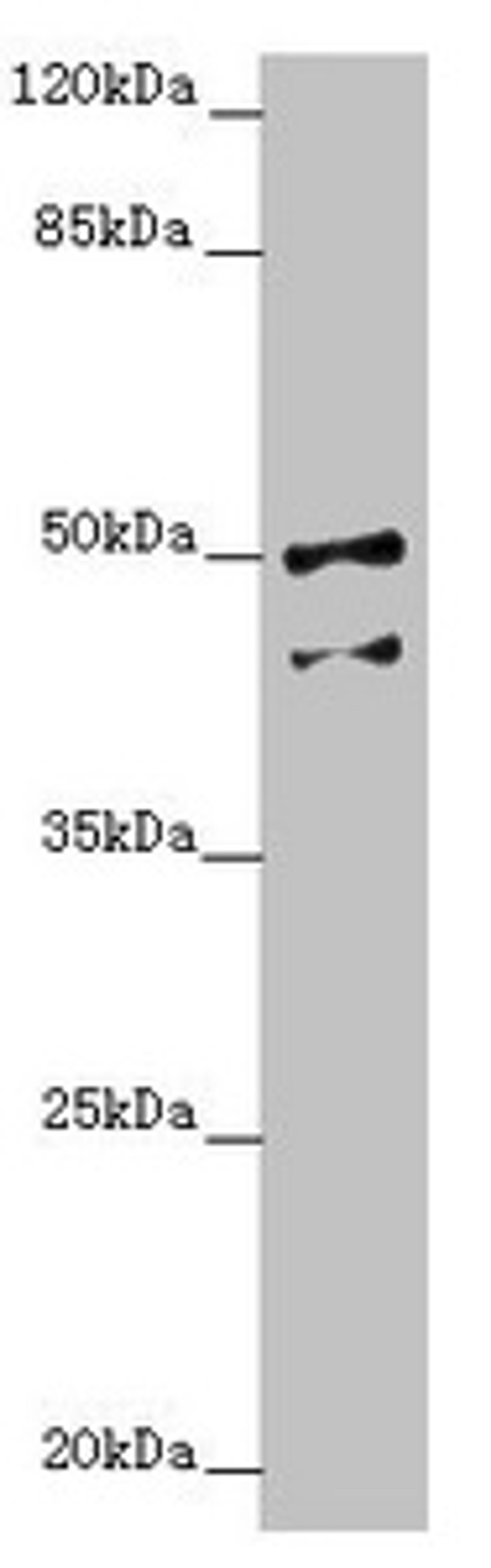 Western blot. All lanes: NPTN antibody at 4.37 ug/ml + Hela whole cell lysate. Secondary. Goat polyclonal to rabbit IgG at 1/10000 dilution. Predicted band size: 45, 32, 31, 38, 44 kDa. Observed band size: 45, 50 kDa.