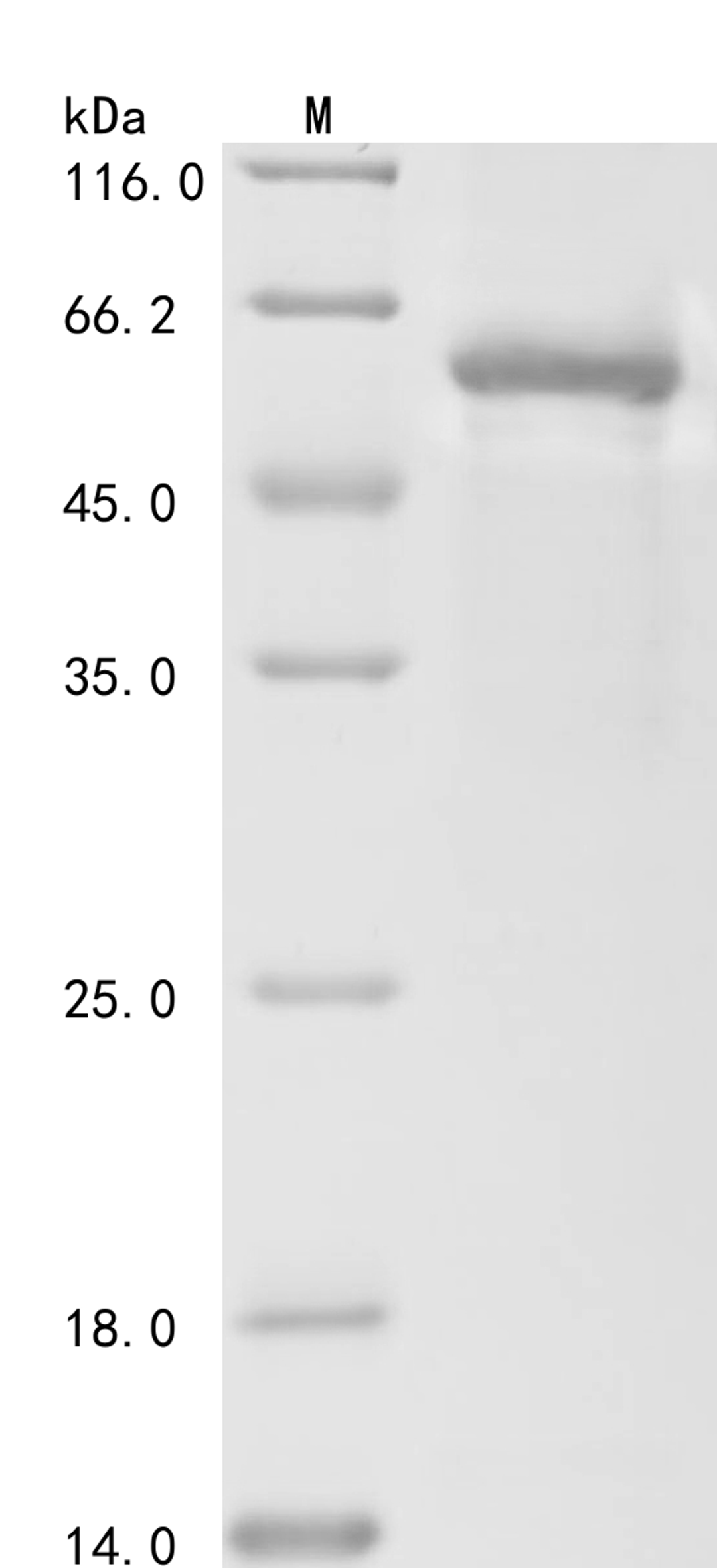 (Tris-Glycine gel) Discontinuous SDS-PAGE (reduced) with 5% enrichment gel and 15% separation gel.