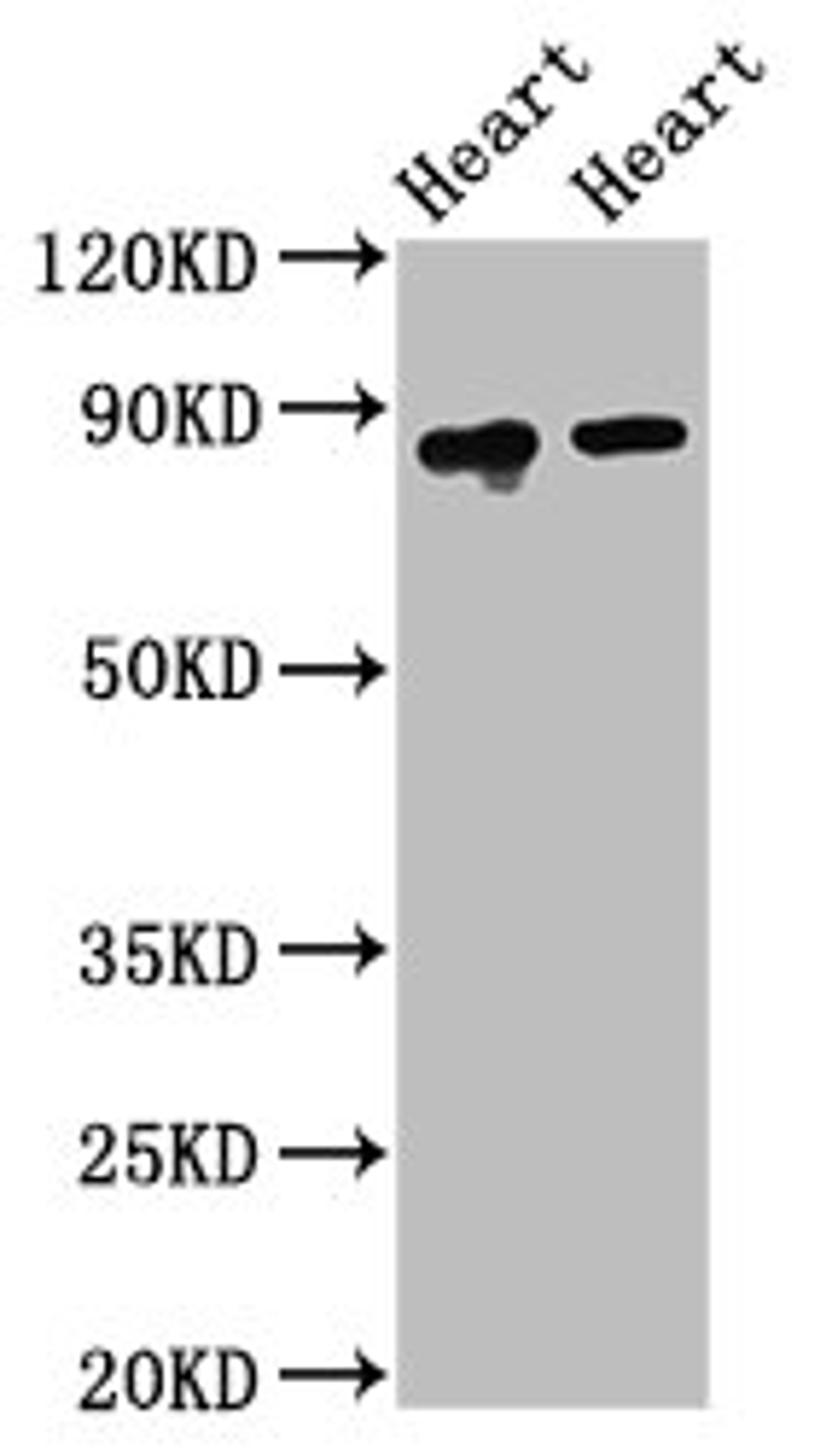 Western Blot. Positive WB detected in: Rat heart tissue, Mouse heart tissue. All lanes: ACO2 antibody at 2.5ug/ml. Secondary. Goat polyclonal to rabbit IgG at 1/50000 dilution. Predicted band size: 86 kDa. Observed band size: 86 kDa. 