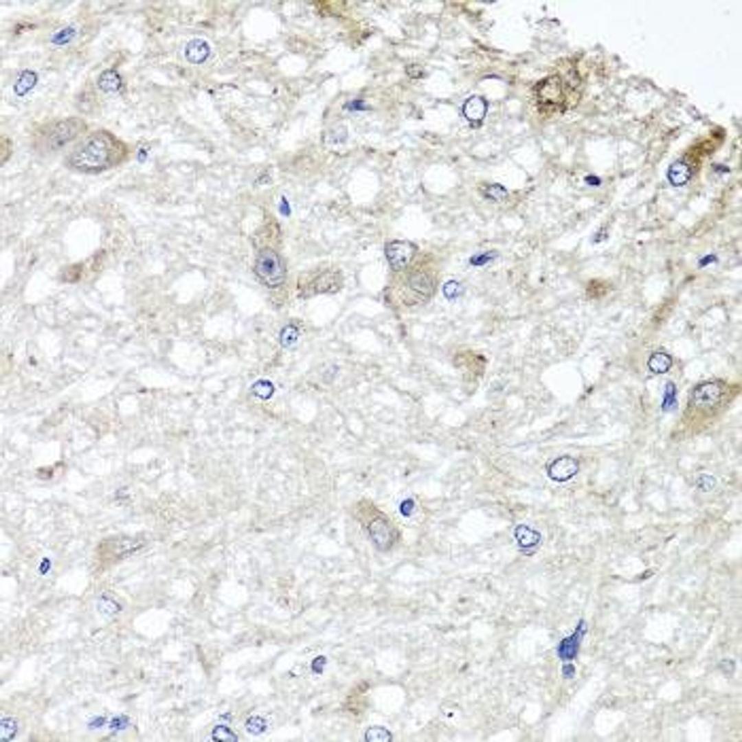 Immunohistochemical staining of rat brain tissue using METTL13 antibody (dilution of 1:100)