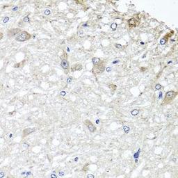 Immunohistochemical staining of rat brain tissue using METTL13 antibody (dilution of 1:100)