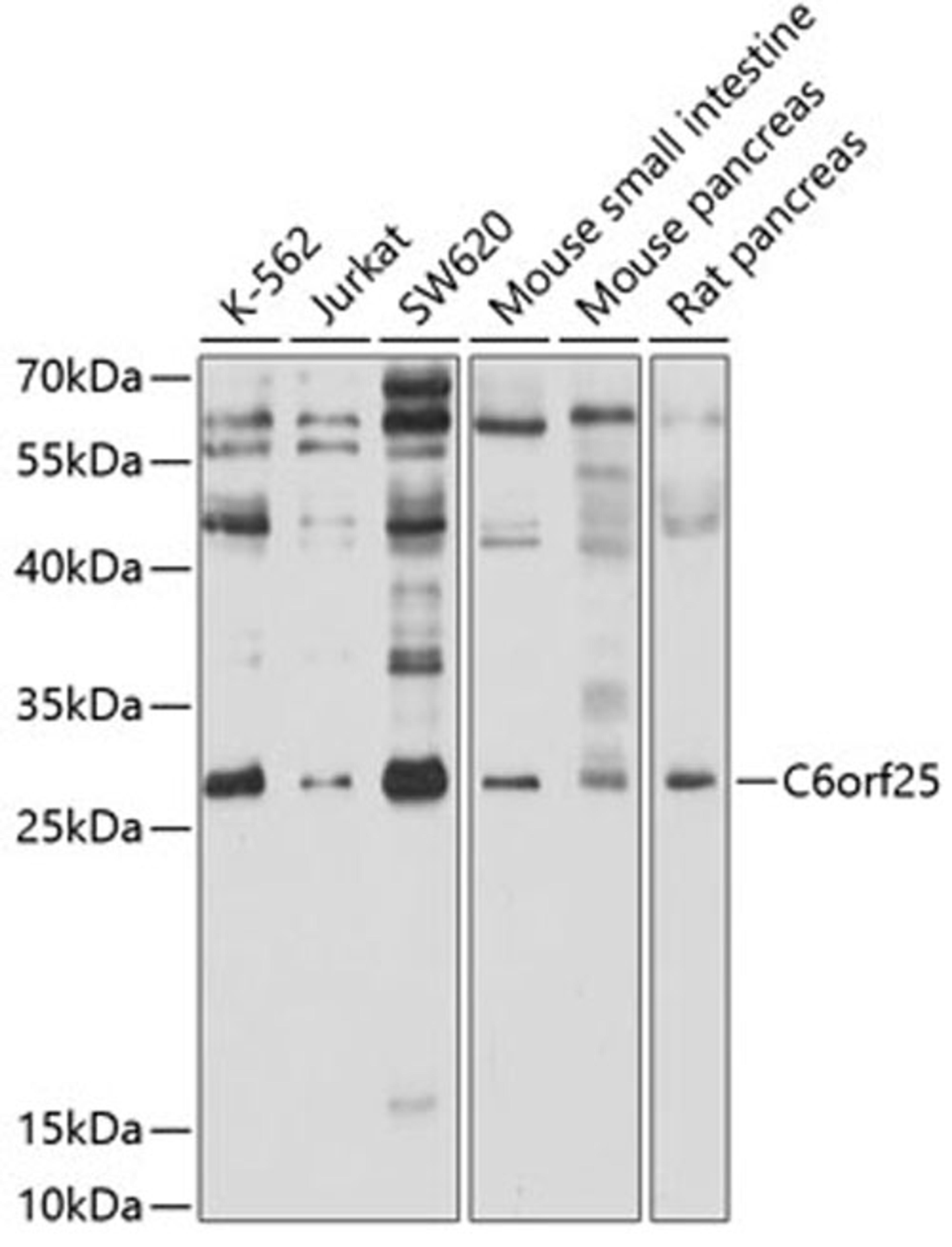 Western blot - C6orf25 antibody (A10154)