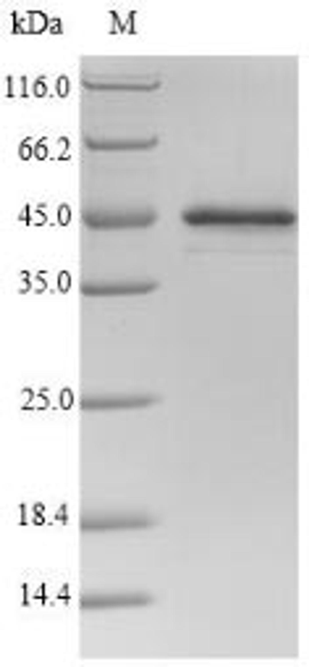 (Tris-Glycine gel) Discontinuous SDS-PAGE (reduced) with 5% enrichment gel and 15% separation gel.