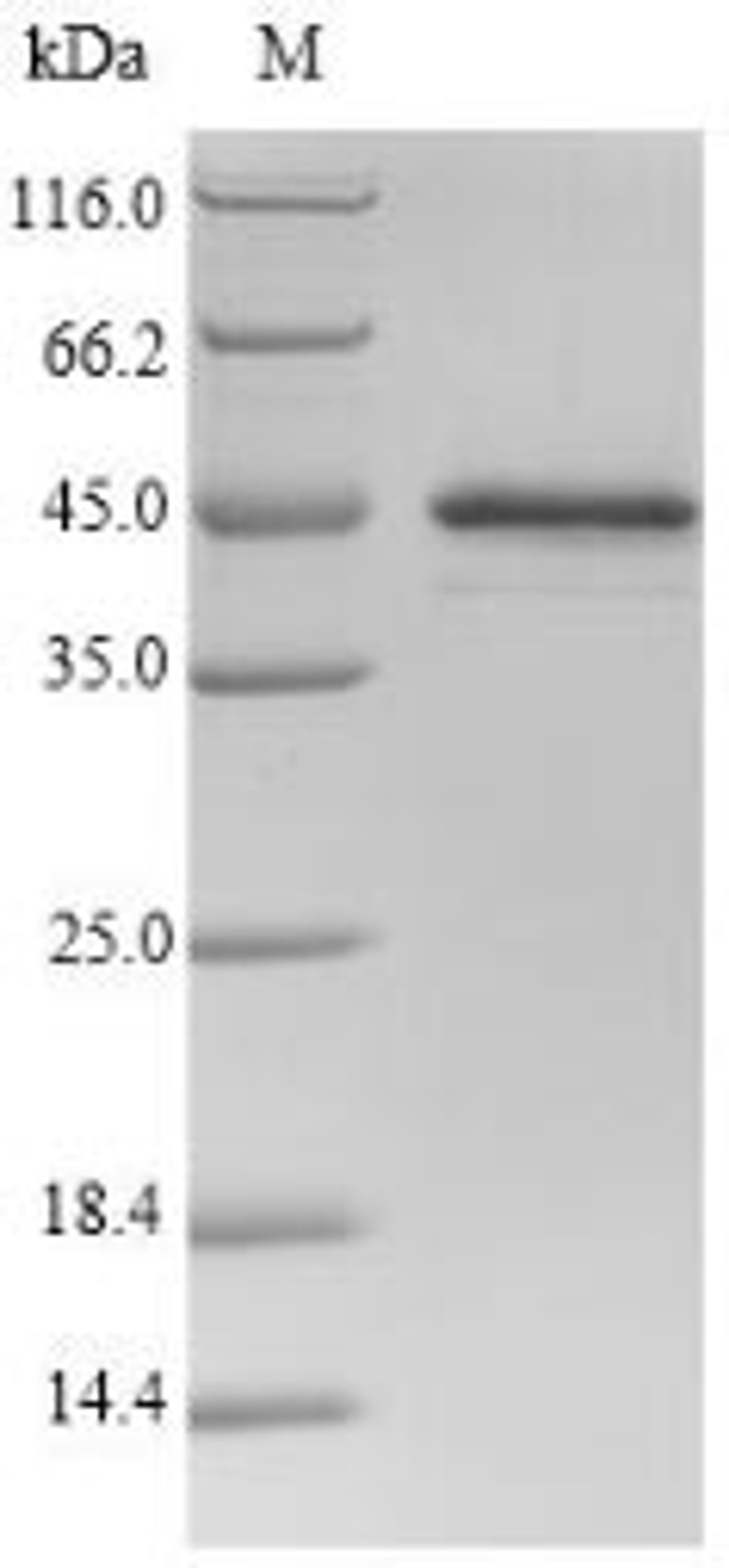 (Tris-Glycine gel) Discontinuous SDS-PAGE (reduced) with 5% enrichment gel and 15% separation gel.