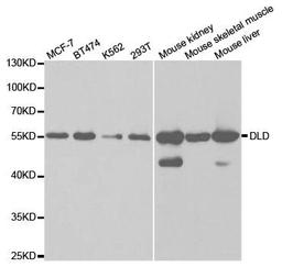 Western blot analysis of extracts of various cell lines using DLD antibody