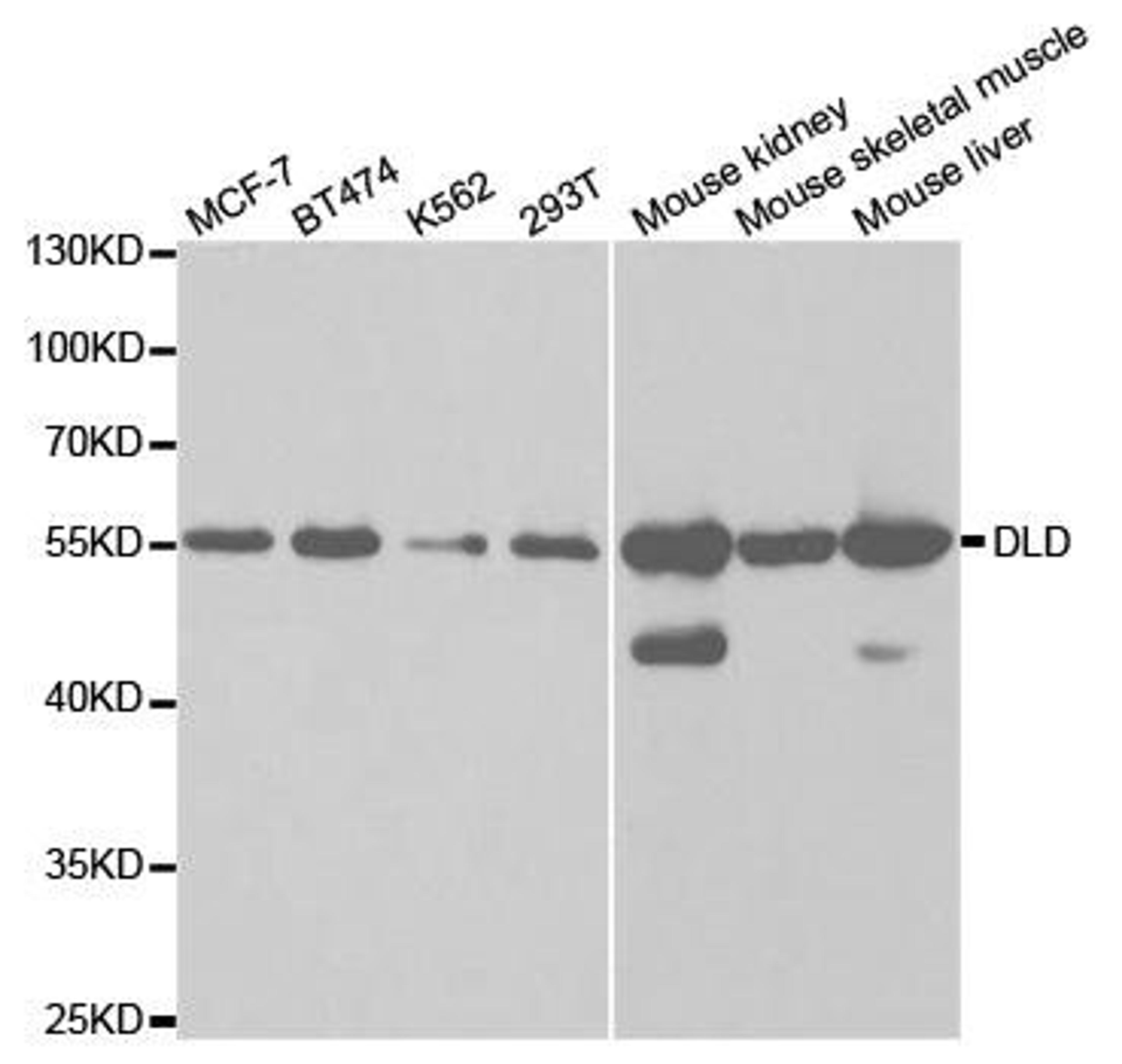 Western blot analysis of extracts of various cell lines using DLD antibody