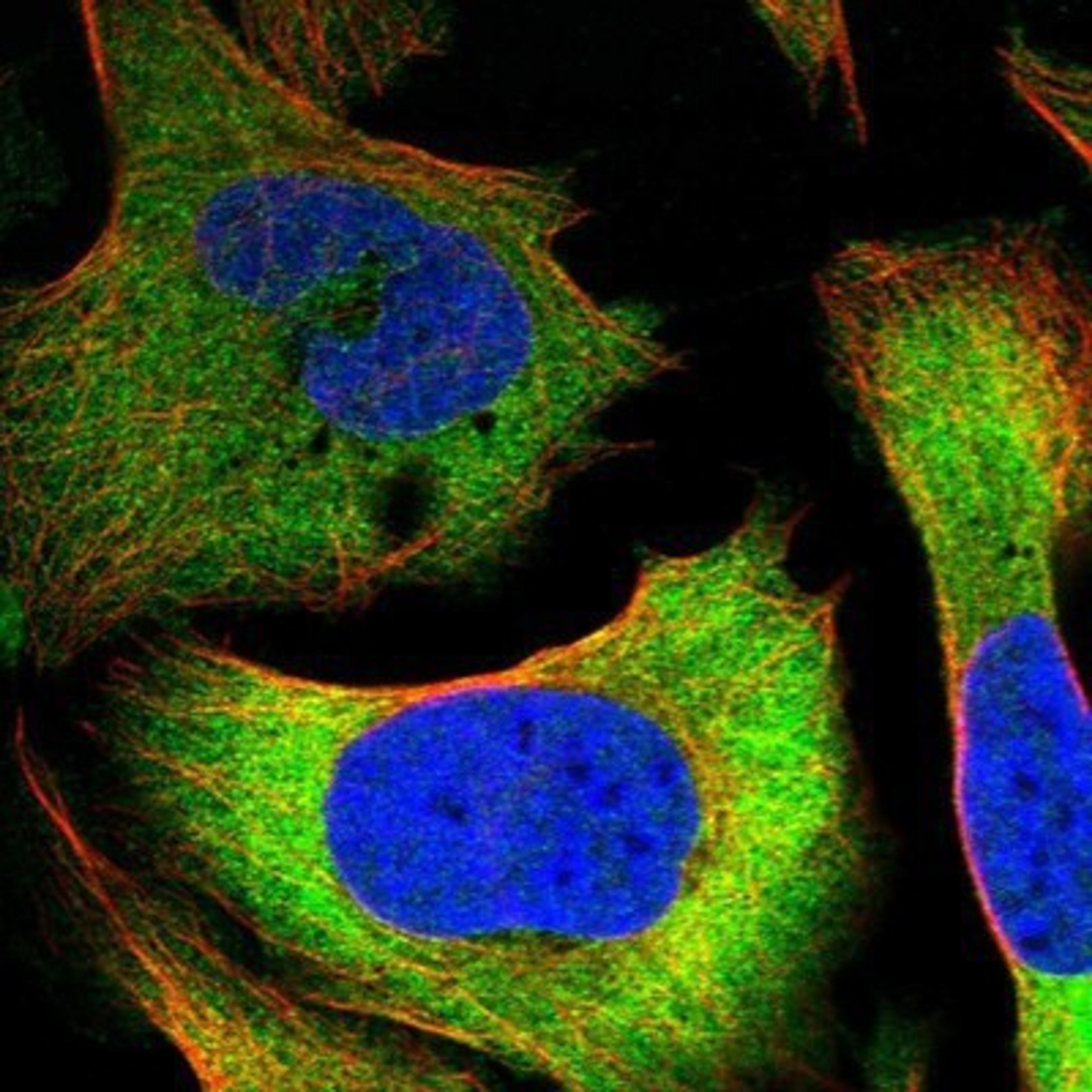 Immunocytochemistry/Immunofluorescence: TCP1-delta Antibody [NBP1-88145] - Staining of human cell line U-2 OS shows positivity in cytoplasm.