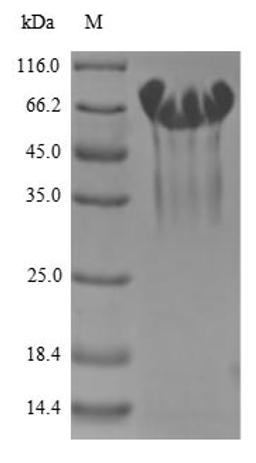 (Tris-Glycine gel) Discontinuous SDS-PAGE (reduced) with 5% enrichment gel and 15% separation gel.