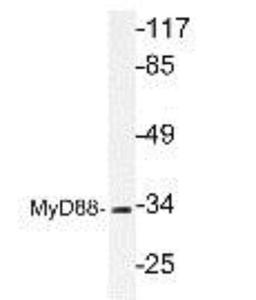 Western Blot: MyD88 Antibody [NBP1-19785] - extracts from COLO cells.