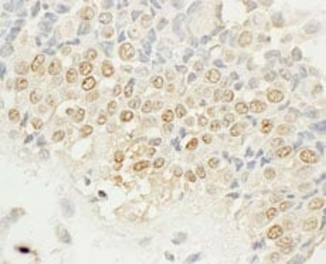 Detection of human NEK4 by immunohistochemistry.