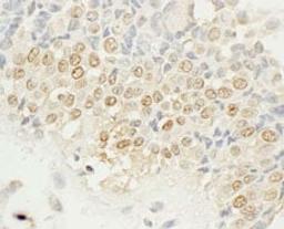 Detection of human NEK4 by immunohistochemistry.