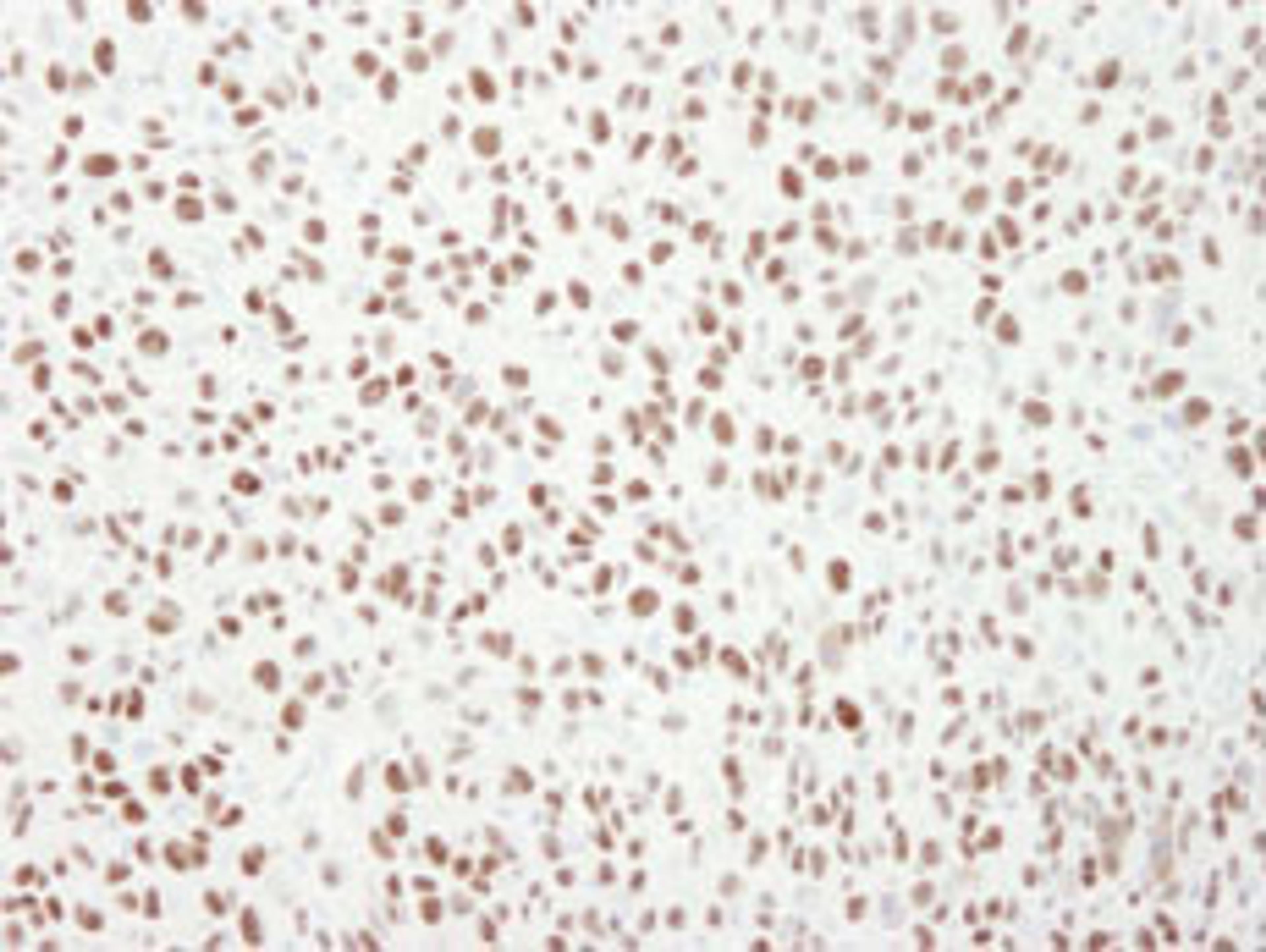 Detection of mouse MCM6 by immunohistochemistry.