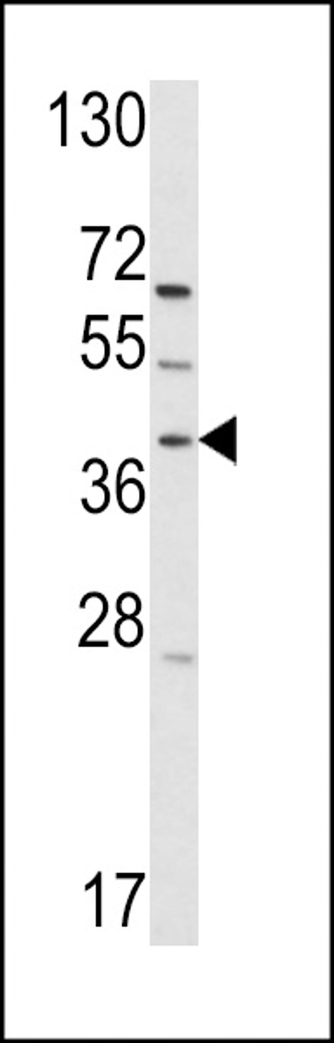 Western blot analysis of hRai3-W343 in T47D cell line lysates (35ug/lane)