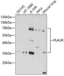 Western blot - PLAUR antibody (A1397)