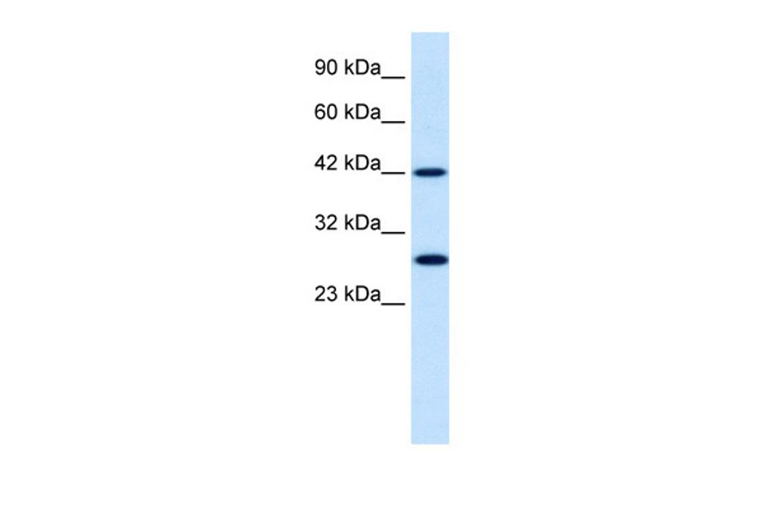 Antibody used in WB on Human Raji cells at 0.3 ug/ml.