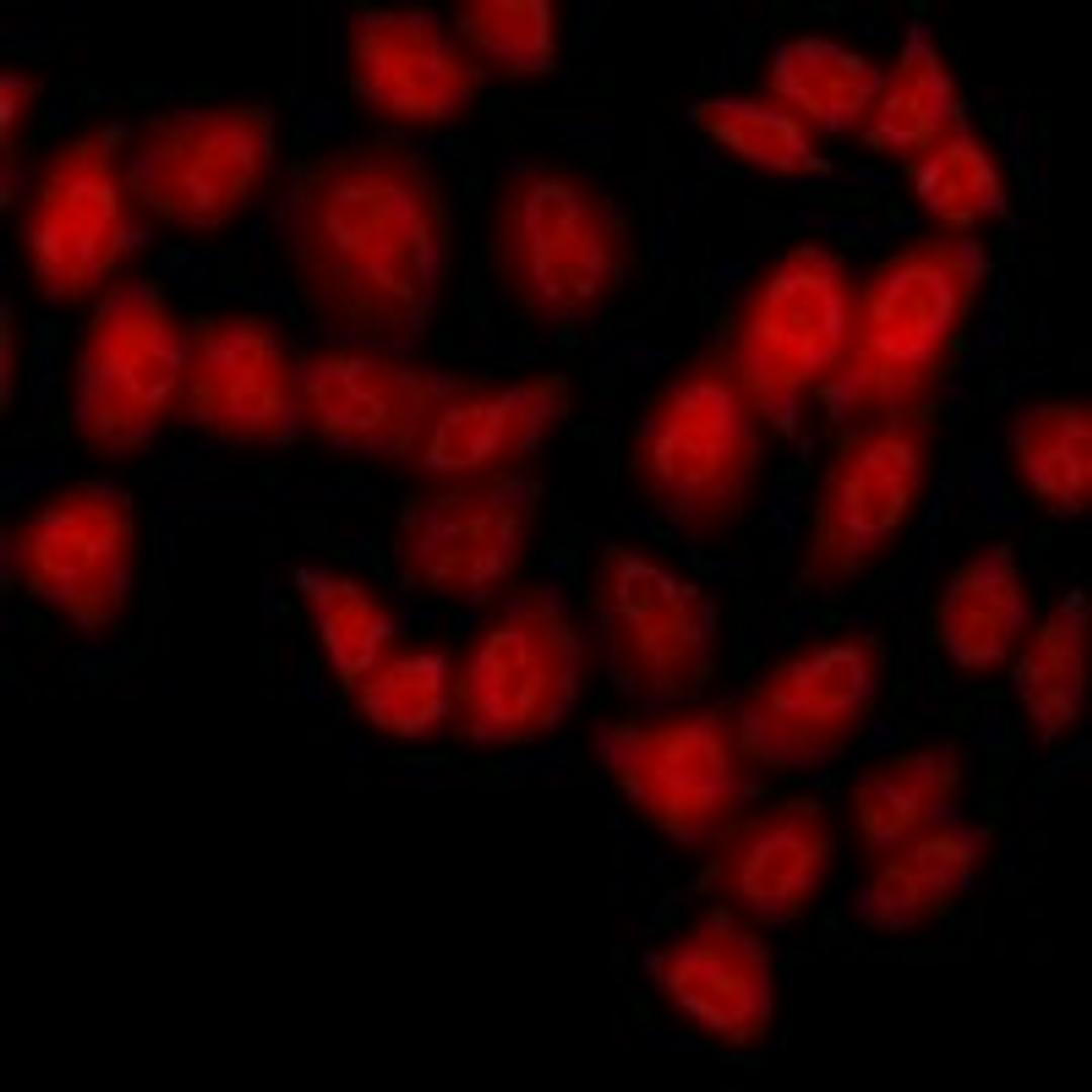 Immunofluorescent analysis of HeLa cells using NUDT6 antibody