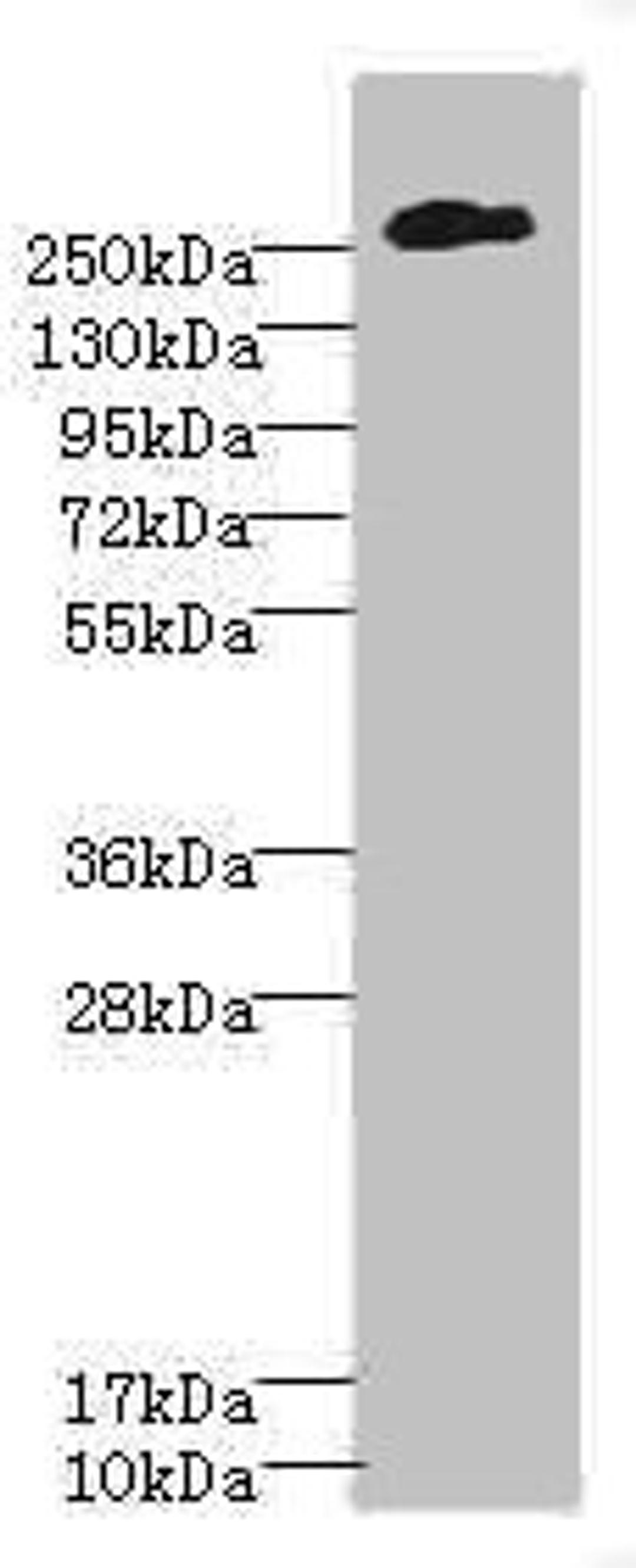 Western blot. All lanes: CSPG4 antibody at 2.51µg/ml + A375 whole cell lysate. Secondary. Goat polyclonal to rabbit IgG at 1/10000 dilution. Predicted band size: 251 kDa. Observed band size: 251 kDa