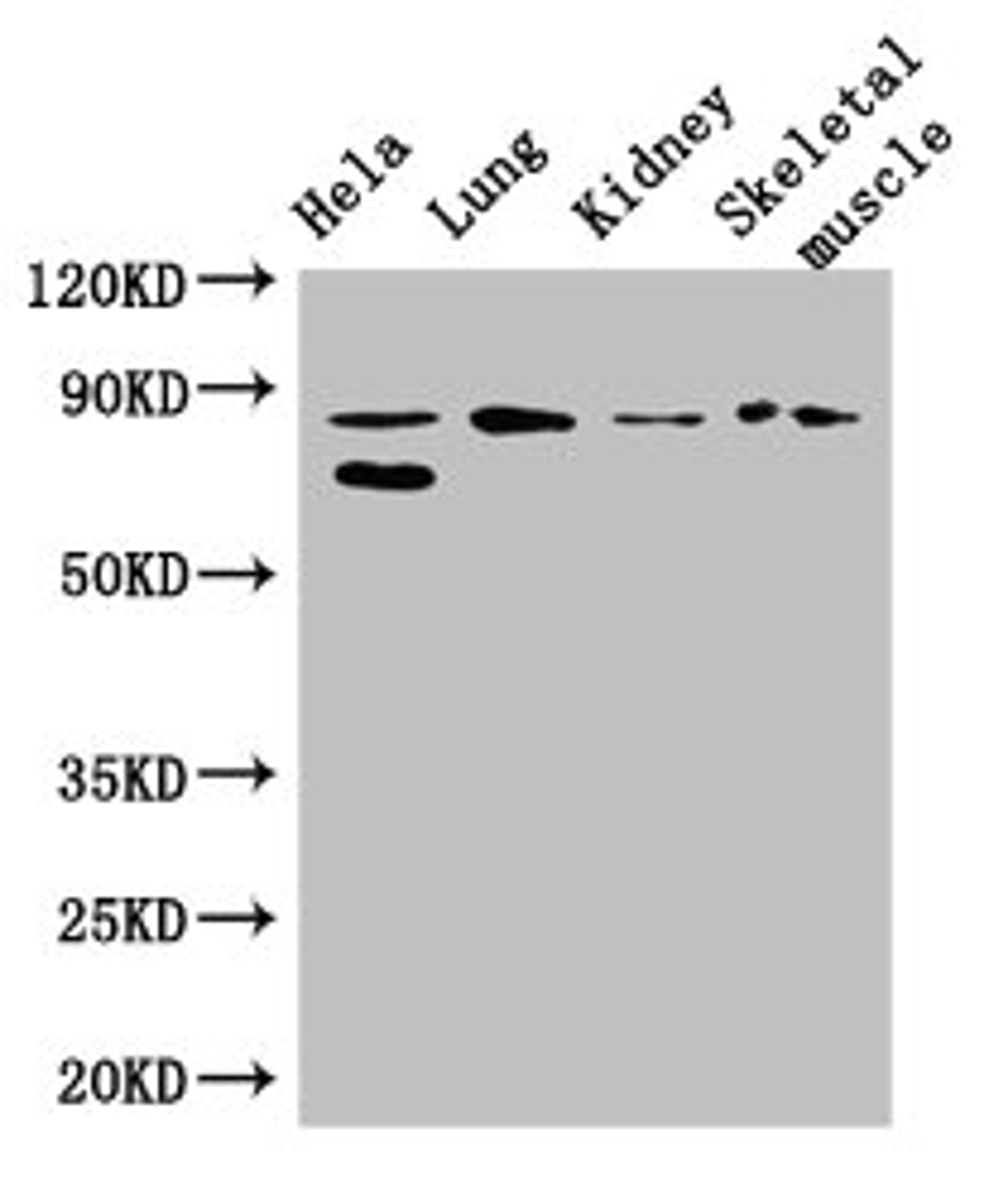 Western Blot. Positive WB detected in: Hela whole cell lysate, Mouse lung tissue, Mouse kidney tissue, Mouse skeletal muscle tissue. All lanes: PRDM4 antibody at 3.4ug/ml. Secondary. Goat polyclonal to rabbit IgG at 1/50000 dilution. Predicted band size: 88 kDa. Observed band size: 88, 70 kDa.