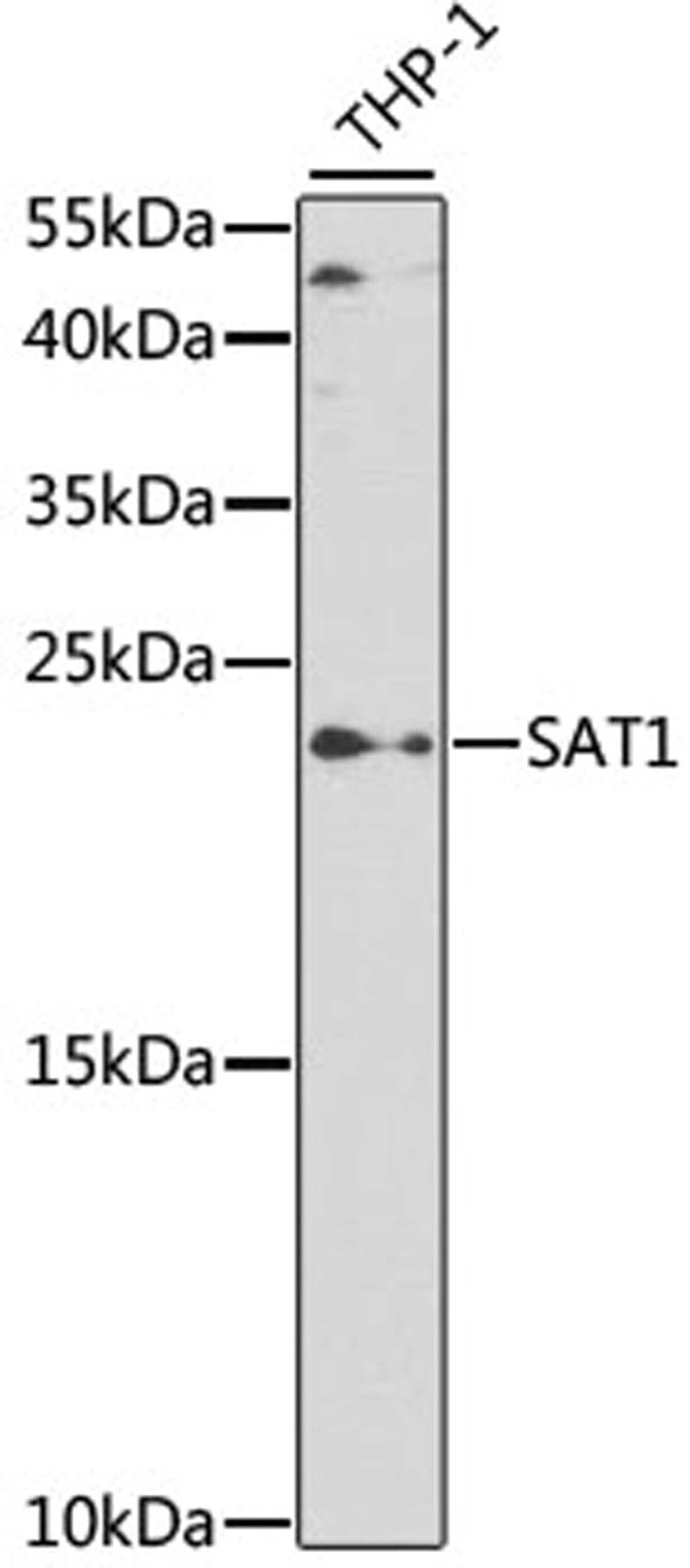 Western blot - SAT1 antibody (A2506)