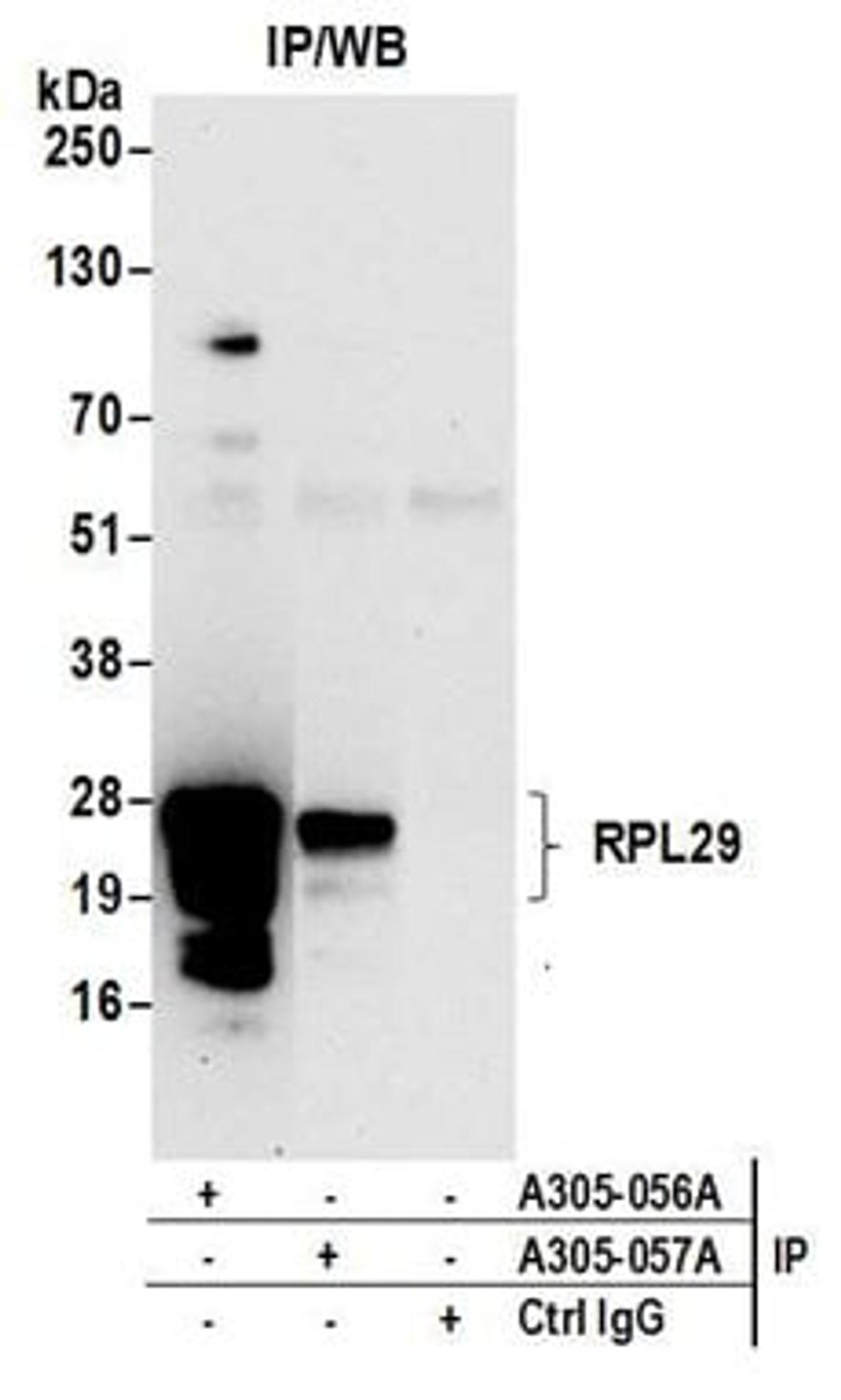 Detection of human RPL29 by western blot of immunoprecipitates.