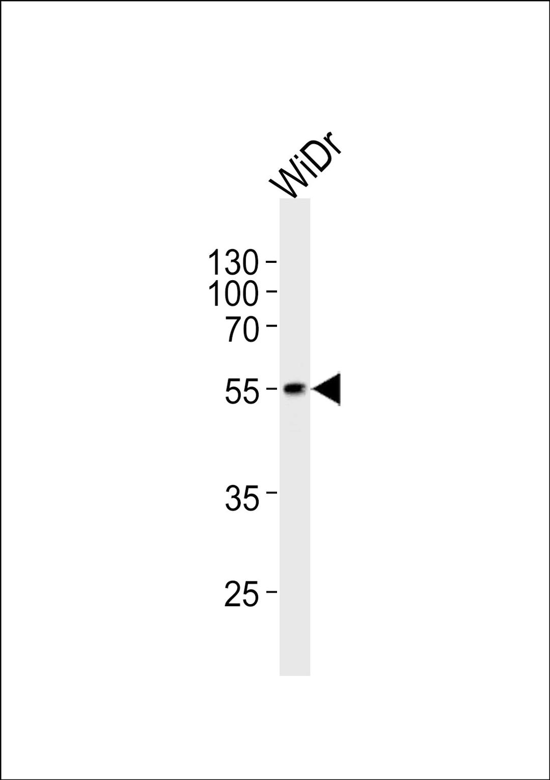 Western blot analysis of lysate from WiDr cell line, using hPDX1R444 at 1:1000 at each lane.