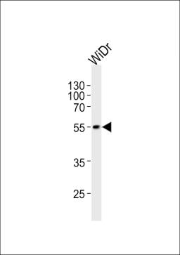 Western blot analysis of lysate from WiDr cell line, using hPDX1R444 at 1:1000 at each lane.