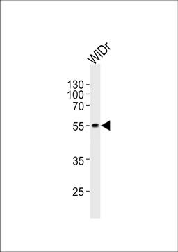 Western blot analysis of lysate from WiDr cell line, using hPDX1R444 at 1:1000 at each lane.