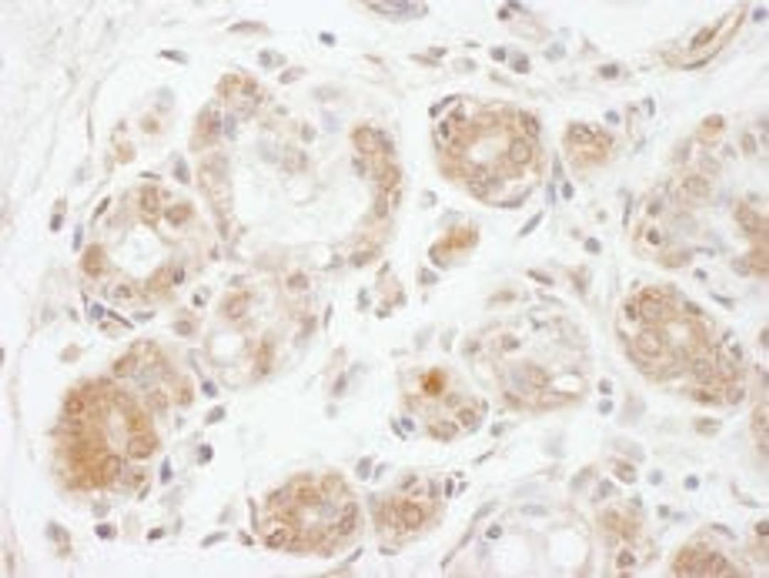 Detection of human DGKzeta by immunohistochemistry.