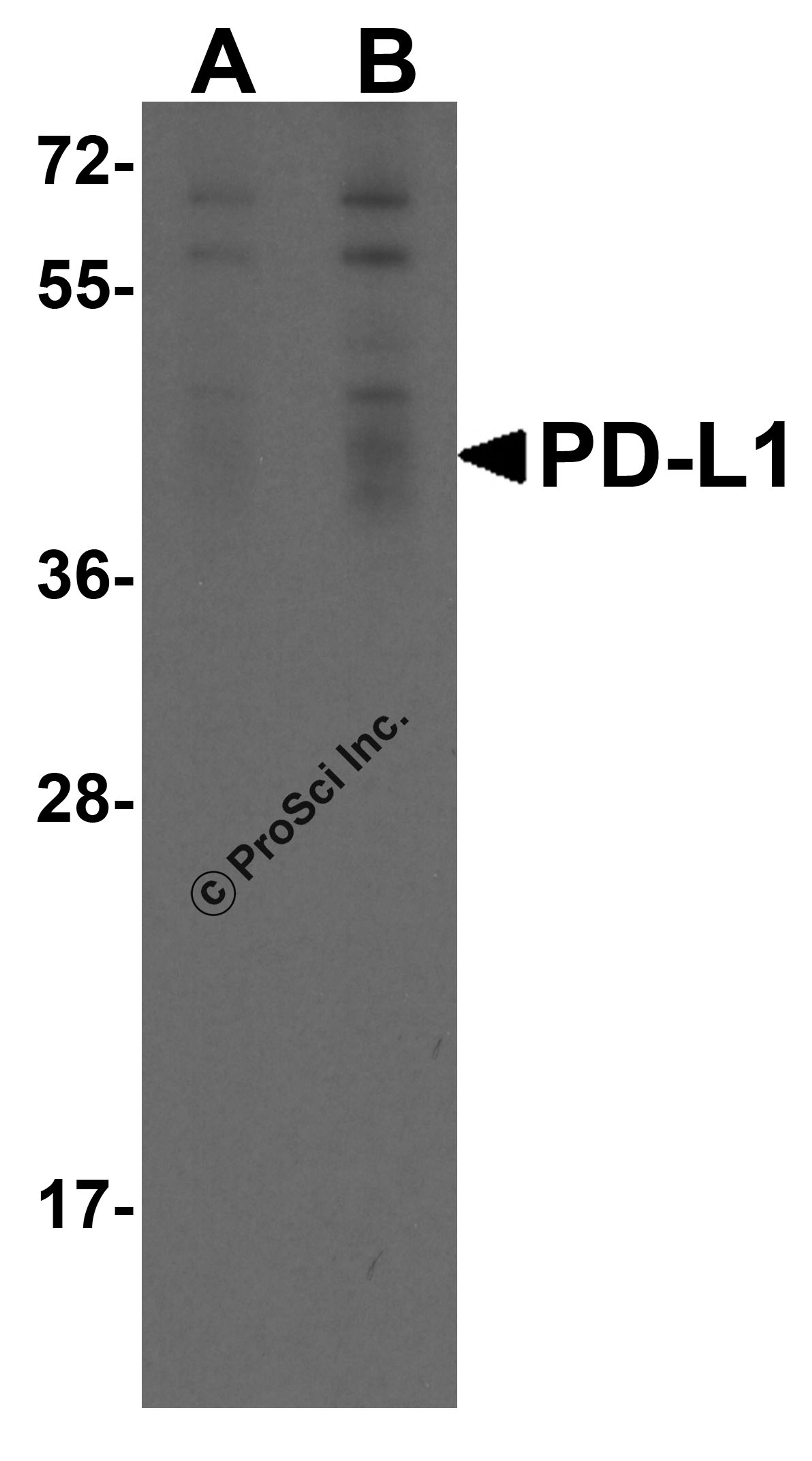 Western blot analysis of PD-L1 in overexpressing HEK293 cells PD-L1 antibody at 0.25 and 0.5 μg/ml