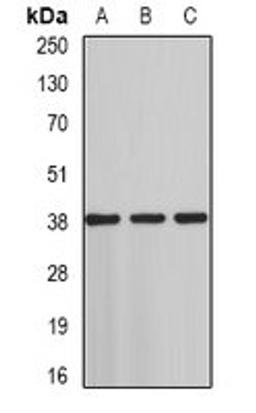 Western blot analysis of HT29 (Lane1), rat testis (Lane2), rat liver (Lane3) whole cell lysates using ST3GAL4 antibody